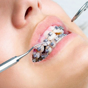 Orthodontics