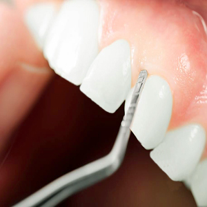 Periodontology